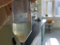 Bacteria-bacteriophage-solution, concentrated from 6 litres of solution